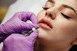 © fotofrol - Young woman receiving a botox injection in her lips, close up