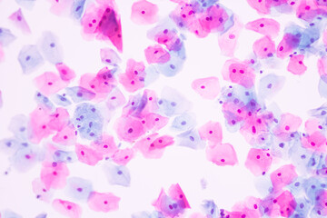 Normal squamous epithelial cells of cervical human view in microscopy.Cytology criteria from pap smear.Medical background concept.