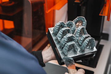 Dental technician removing jaw models from a 3d printer in the laboratory. Model for dental prostheses