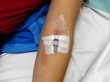 © Sendo - Modern peripheral venous catheter for intravenous infusion in the female arm in the hospital