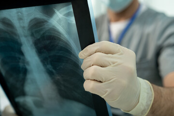 Poster - Doctor analyzing lung x-ray image