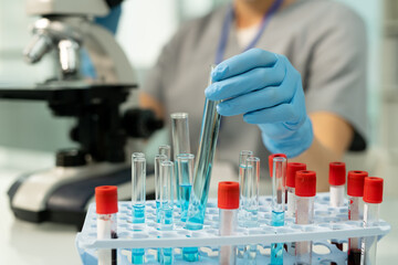Poster - Putting test tube of blue liquid into rack