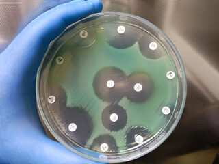 pseudomonas aeruginosa for susceptibility testing drug on mueller hinton agar plate in experiments m