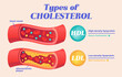 Types of cholesterol comparison with HDL and LDL