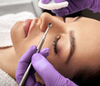 © Peakstock - Facial cleansing to a woman with a mechanical blackhead extractor to remove comedones, blackheads, acne. Close-up