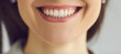 © Studio Romantic - Closeup of young woman's beautiful real natural smile. Close up shot of lower part of face of happy smiling lady with perfect white even teeth. Oral care, dental health, stomatology and beauty concept