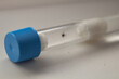 Ixodid tick in a test tube close up. These dangerous ticks should be investigated for encephalitis and borreliosis (Lyme disease)