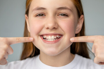 The girl smiles and shows her uneven teeth with her hands. Dental medicine and healthcare