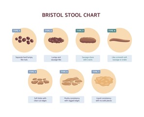bristol stool chart with medicine description of human excrements.