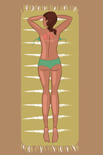 Girl Lying On A Beach Towel, Got A Sunburn