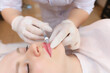© Roman - The cosmetologist pushed the needle from the syringe into the girl's lips to the very base trying to evenly inject hyaluronic acid. The blood droplets act as a result of the previous injections