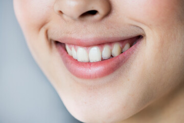 Wall Mural - Close up portrait of Young Asian girl teeth smiling