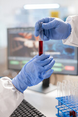 Wall Mural - Close up of scientist hands dressed in ppe suit holding blood test tube. Team doctors working with various bacteria, tissue and blood samples, pharmaceutical research for antibiotics.