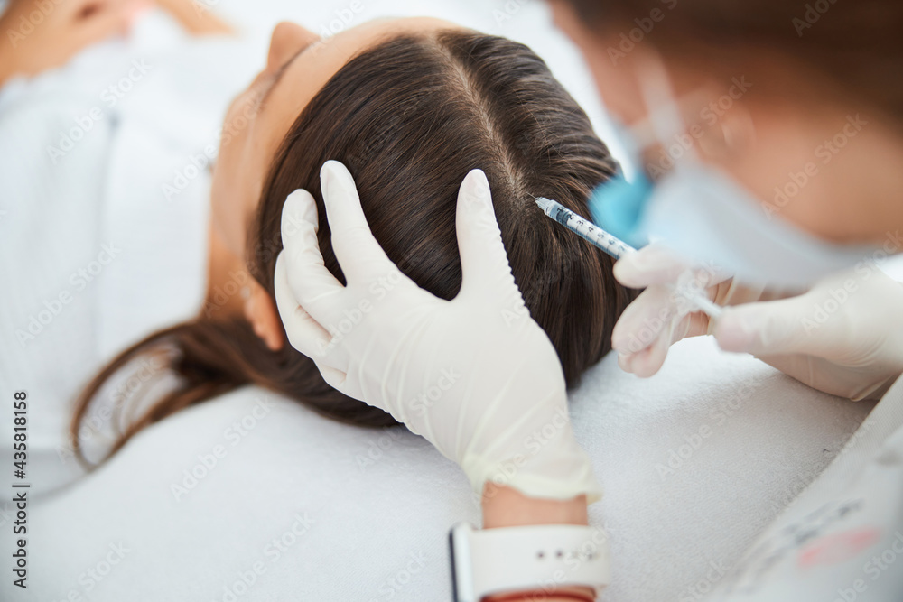 Dermatologist injecting the serum into the female scalp - obrazy, fototapety, plakaty 