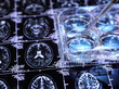 © Image Source RF - Petri dish on brains can