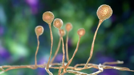 Canvas Print - Mucor mold, black fungus, yellow fungus, 3D animation. Opportunistic fungi that cause mucormycosis involving skin, nasal sinuses, brain and lungs. Complication of Covid-19