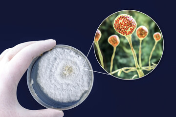 Sticker - Colony of Mucor fungi grown on Petri dish. Also known as black fungus, or bread mold.