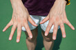 Close up of woman showing her bulging hand veins. Bulging veins can occur due to temporarily rising blood pressure or body temperature when you're exercising or working.