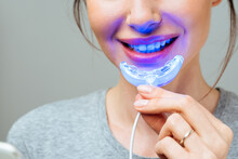 A Young Woman Is Engaged In Home Teeth Whitening. Complex For Teeth Whitening With UV Lamp