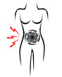 Stilisierter Frauenkörper mit Schmerzpunkt im Bauch