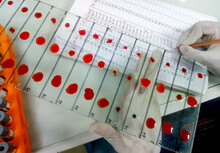 Doctor Or Scientist Check Blood Group Of Patient Or Donor. ABO Blood Grouping By Slide Test Technique.