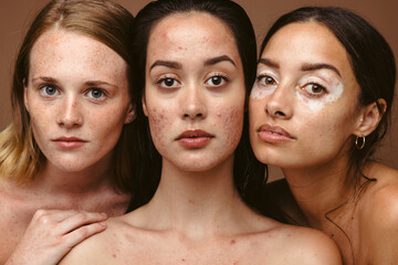 Wall Mural - stong woman with skin imperfections