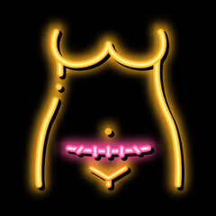 Wall Mural - cesarean section neon light sign vector. Glowing bright icon cesarean section sign. transparent symbol illustration