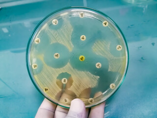 Wall Mural - Antimicrobial susceptibility testing in petri dish with Muller Hinton agar medium,Susceptibility of Staphylococcus aureus bacteria