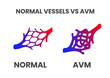 Normal vessels and arteriovenous malformation (avm)