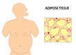 Adipose Tissue cells. Obesity illustration with adipose tissue cells. 