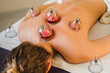 © Irina Efremova/Stocksy - Hijama therapy