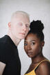© Jovana Rikalo/Stocksy - Portrait of a young black woman and male albino