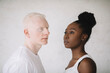 © Jovana Rikalo/Stocksy - Portrait of a young black woman and male albino