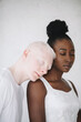 © Jovana Rikalo/Stocksy - Portrait of a young black woman and male albino