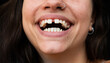 © Felix Chacon/Stocksy - close up of a beautiful woman smiling with diastema