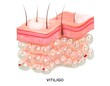 Realistic human cross-section skin layers structure with vitiligo. 3d medical dermis illustration