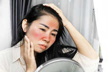 Sad Asian Woman Having Problem With Sunburn On Face , Checking Her Redness Skin On A Mirror Because Of Ultraviolet From Sunlight