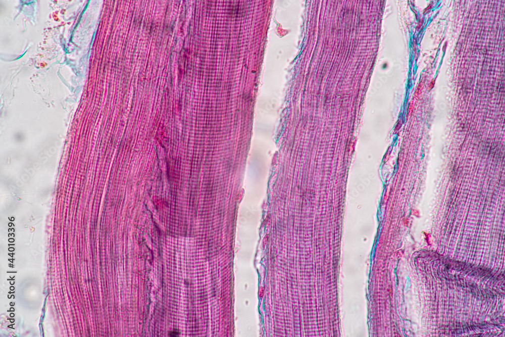 Striations Microscope Characteristics of anatomy and Histological sample Striated (Skeletal ...