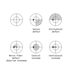 Wall Mural - amsler test grid. eye scotoma chart. oculist vector printable chart retina examination. grid with do