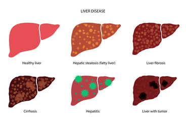 Sticker - Liver disease concept