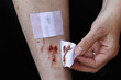 Eine Frau hat eine blutende Verletzung am Bein