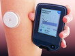 Closeup od device for continuous glucose monitoring in blood – CGM. This device wirelessly continuously reads sensor on skin and monitors glucose level in real time. Diabetes type 1. Insulin depend