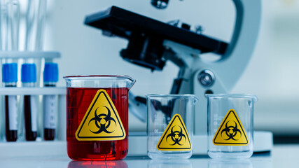 Wall Mural - Glassware with biohazardous liquid on table