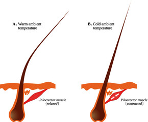Fototapete - piloerection: erection or bristling of hairs as a reflexive response of the sympathetic nervous syst