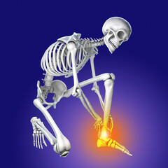 Sticker - Foot and ankle pain, conceptual 3D illustration