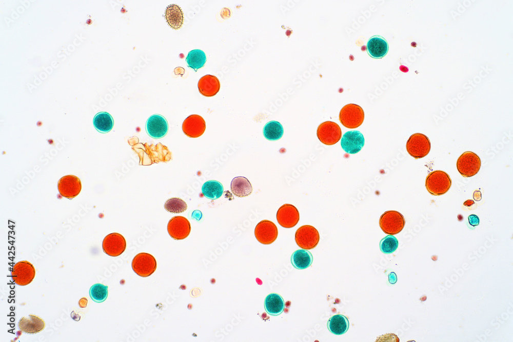 Pollen grain is the microscopic body that contains the male ...