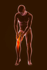 Poster - Painful knee, anatomy and medicine concept