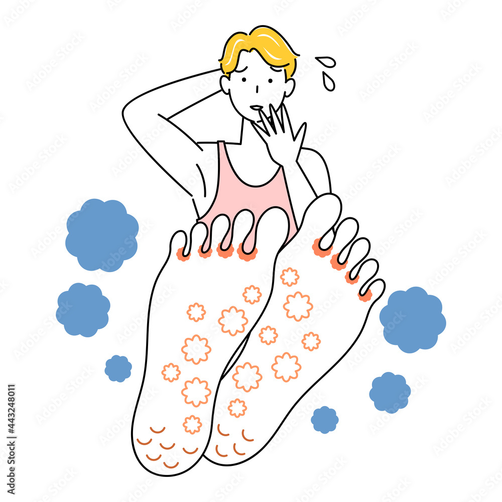 スキンケア 足が水虫になってしまい悲しんでいる可愛い男性 足裏のアップ イラスト ベクター Skin Care A Cute Guy Who Is Sad Because His Feet Have Athlete S Foot Sit Cross Legged Illustration Vector Wall Mural みやもとかずみ