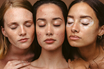 woman with unique skin
