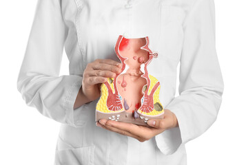 Wall Mural - Doctor holding model of unhealthy lower rectum with inflamed vascular structures on white background, closeup. Hemorrhoid problem